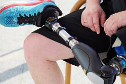 В СФ хотят расширить маркировку комплектующих для протезов