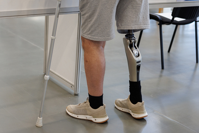 инвалид протез ноги 